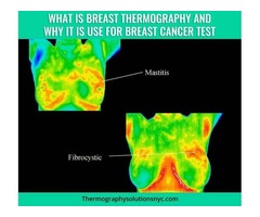 Thermography Solution NY | Manhasset - What is Thermography? | free-classifieds-usa.com - 1
