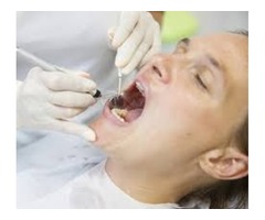 What Are Impacted Wisdom Teeth? | free-classifieds-usa.com - 1