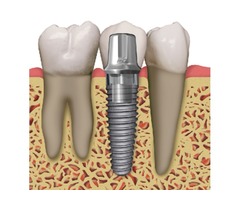 Southtowns Dental | free-classifieds-usa.com - 1