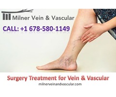 Surgery Treatment for Vein & Vascular | free-classifieds-usa.com - 1