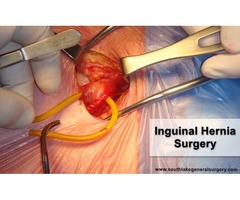 Laparoscopic Hernia Repair Surgery Southlake Texas USA  | free-classifieds-usa.com - 3