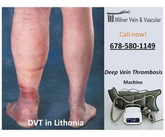 Deep Vein Thrombosis in Lithonia | free-classifieds-usa.com - 1