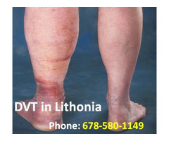 DVT Surgery Treatment in Lithonia | Call 678-580-1149 | free-classifieds-usa.com - 1
