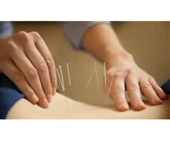 Looking for Acupuncture Therapy in West Loop? | free-classifieds-usa.com - 1