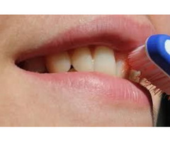 Dental clinic La Grange KY | free-classifieds-usa.com - 4