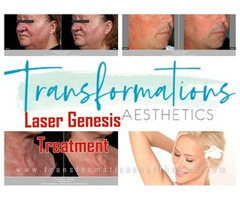 Get Rid of Scars with an Effective Laser Genesis Treatment | free-classifieds-usa.com - 1