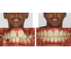 Orthodontist Valencia | free-classifieds-usa.com - 1