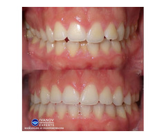 Best Orthodontist For Braces Near Me | free-classifieds-usa.com - 1