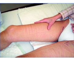 vein treatment in Long Island | free-classifieds-usa.com - 1
