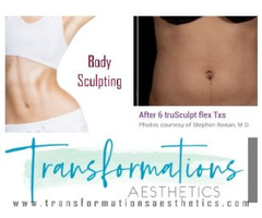 Get Rid of Excess Skin with These Body Sculpting Treatments | free-classifieds-usa.com - 1