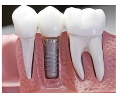 Family dentist Malden MA | free-classifieds-usa.com - 1