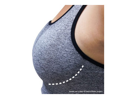 Breast Augmentation NY | free-classifieds-usa.com - 1