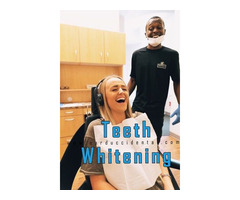 Teeth Whitening near me is an Affordable Solution for A Brighter Smile | free-classifieds-usa.com - 1