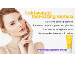 Touch Benzoyl Peroxide Acne Treatment Gel at Best Price | free-classifieds-usa.com - 1