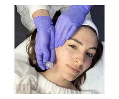 PRP Microneelding NYC | Karmina Beauty Clinic | free-classifieds-usa.com - 1