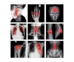 Catastrophic Injury Lawyer Connecticut  | free-classifieds-usa.com - 1