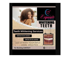  Teeth Whitening Services | free-classifieds-usa.com - 1