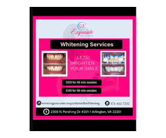  Teeth Whitening Services | free-classifieds-usa.com - 2