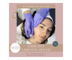 PRP Microneedling Service NYC | Karmina Beauty Clinic | free-classifieds-usa.com - 1