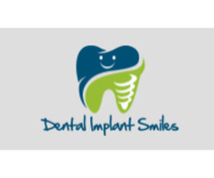 Dental Implants Bucks County PA | free-classifieds-usa.com - 1