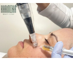 PRP Microneedling Treatment NYC | Karmina Beauty Clinic | free-classifieds-usa.com - 1