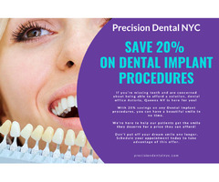 Precision Dental NYC offers a 20% discount on dental implant procedures. | free-classifieds-usa.com - 1