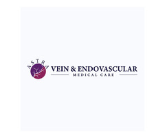 Advantages of Services in Astra Vein Treatment Center | free-classifieds-usa.com - 1