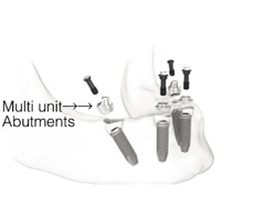 Yardley Dental Implants | free-classifieds-usa.com - 3