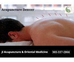Treat Health Problems With Acupuncture | free-classifieds-usa.com - 1