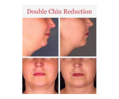 Double Chin Reduction in New York | free-classifieds-usa.com - 1