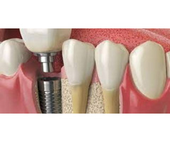 Opelika Dental Associates- The Dentist for Your Needs | free-classifieds-usa.com - 1