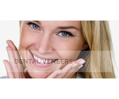 Best Veneer Treatment in Kendall FL - Miami Dental Group | free-classifieds-usa.com - 3