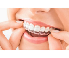 Invisalign in Cottleville | free-classifieds-usa.com - 1