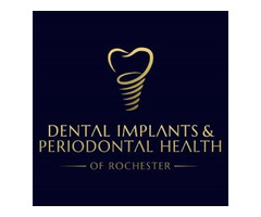 Periodontal Plastic Surgery in Rochester NY - Dental Implants and Periodontal Health | free-classifieds-usa.com - 1