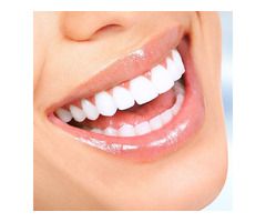 Teeth Whitening Near Me | free-classifieds-usa.com - 1