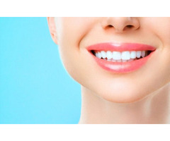 Teeth Whitening in Cottleville | free-classifieds-usa.com - 1