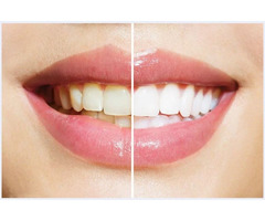 de Bruin Dental Center | free-classifieds-usa.com - 1