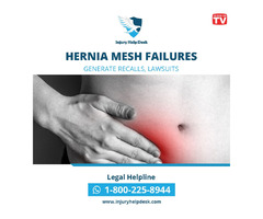 HERNIA MESH FAILURES GENERATE RECALLS, LAWSUITS | free-classifieds-usa.com - 1