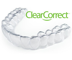 Attractive Clear Correct Braces At Warren County | free-classifieds-usa.com - 1
