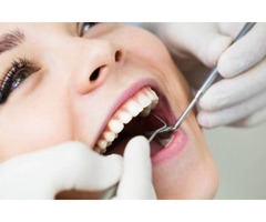 Cost Of Braces For Teeth |  How to Qualify for Free Braces | DentalSave USA | free-classifieds-usa.com - 1