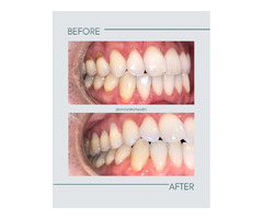 Smile for Health Dental Clinic in Carlsbad, CA 92009 | free-classifieds-usa.com - 1