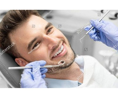 Cavity Fillings in Albion NY - Albion Family Dental | free-classifieds-usa.com - 2