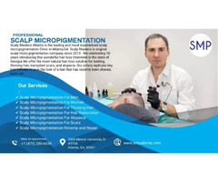 3D Scalp Micropigmentation – Scalp Masters Atlanta (SMP Atlanta) | free-classifieds-usa.com - 1