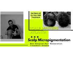3D Scalp Micropigmentation – Scalp Masters Atlanta (SMP Atlanta) | free-classifieds-usa.com - 2