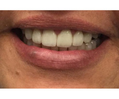 Ensure Careful Evaluation of Your Teeth at POM Dental Studio | free-classifieds-usa.com - 1