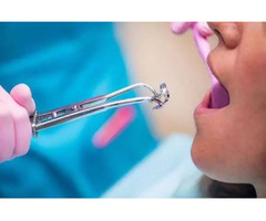Dental Services: Root Canal Treatment in Thousand Oaks, CA | free-classifieds-usa.com - 1