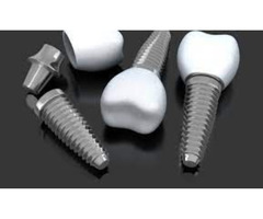 4 On 4 Dental Implants | free-classifieds-usa.com - 1