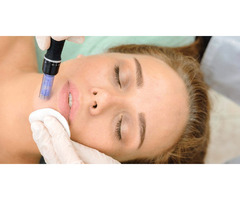 Microneedling Treatment in San Diego | free-classifieds-usa.com - 1