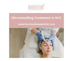 Microneedling Treatment NYC | Karmina Beauty Clinic  | free-classifieds-usa.com - 1