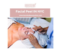 Faical Peel NYC | Karmina Beauty Clinic | free-classifieds-usa.com - 1